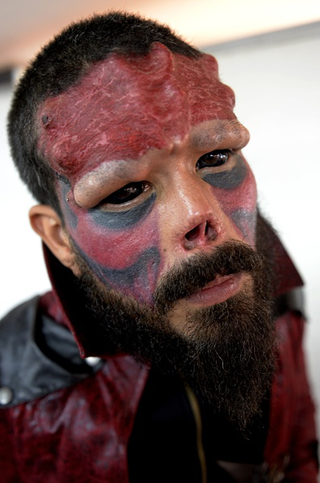 Illustration for article titled Man Removes Nose to Look More Like Red Skull